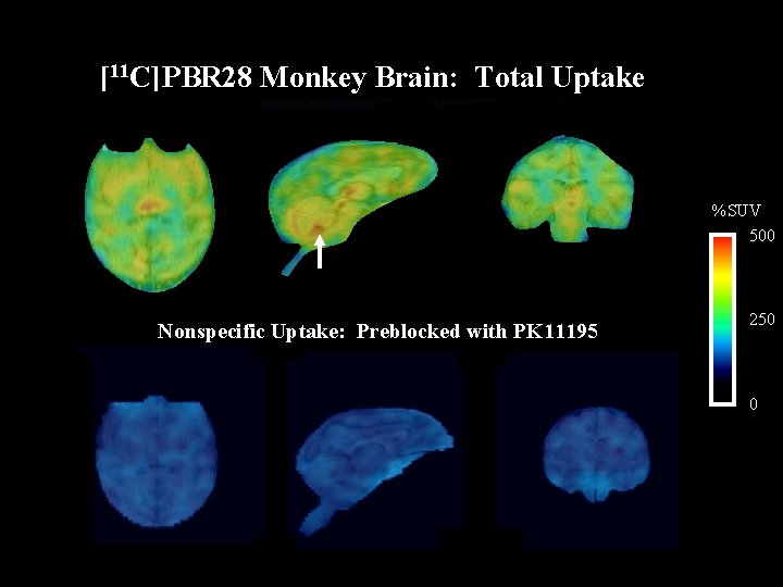 [11 C]PBR 28 Monkey Brain: Total Uptake %SUV 500 Nonspecific Uptake: Preblocked with PK