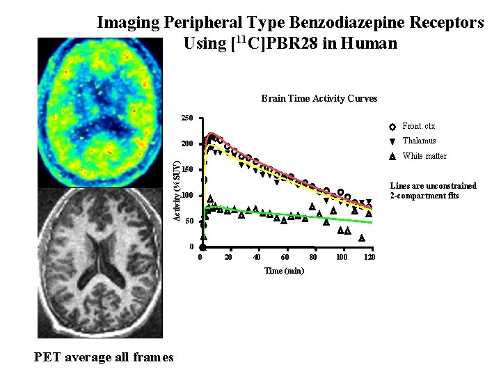 Imaging Peripheral Type Benzodiazepine Receptors Using [11 C]PBR 28 in Human Brain Time Activity