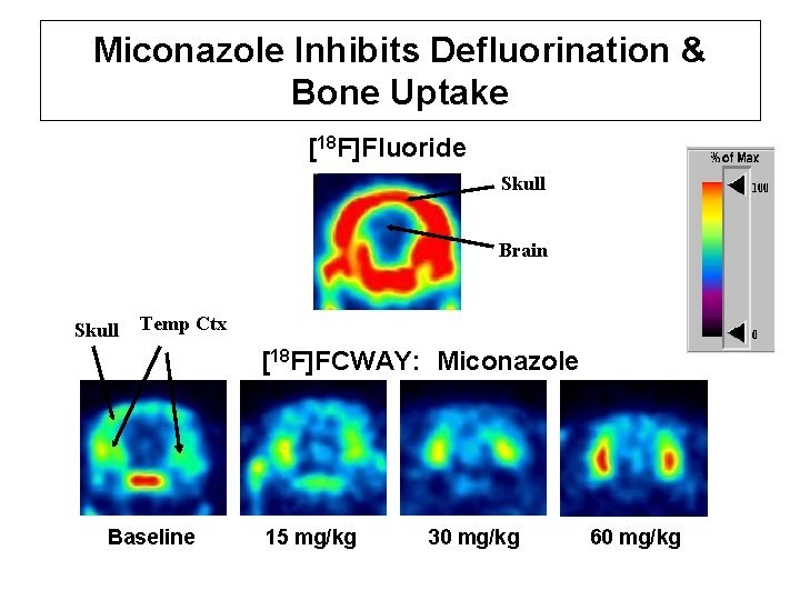 Miconazole Inhibits Defluorination & Bone Uptake [18 F]Fluoride Skull Brain Skull Temp Ctx [18