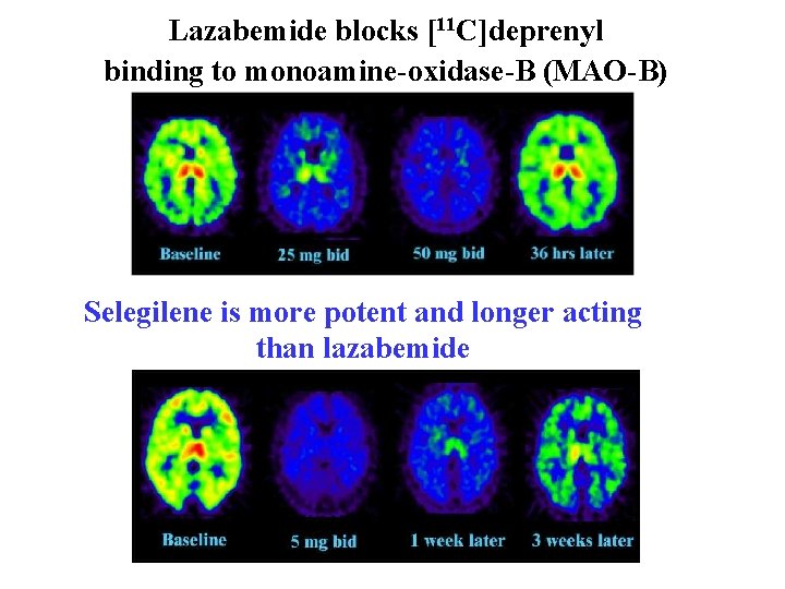 Lazabemide blocks [11 C]deprenyl binding to monoamine-oxidase-B (MAO-B) Selegilene is more potent and longer