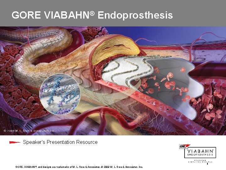 GORE VIABAHN® Endoprosthesis Speaker’s Presentation Resource GORE, VIABAHN ®, and designs are trademarks of
