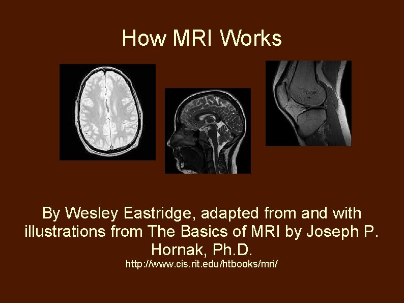 How MRI Works By Wesley Eastridge, adapted from and with illustrations from The Basics