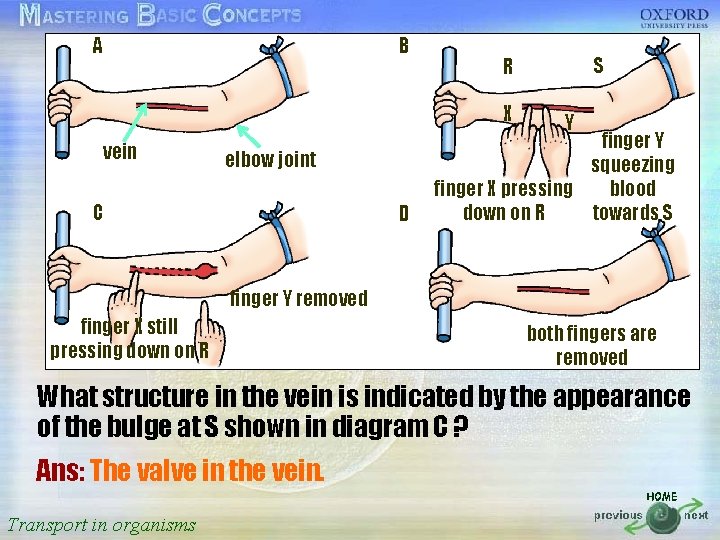 A B R S 按一下以編輯母片標題樣式 X Y vein elbow joint finger Y squeezing finger