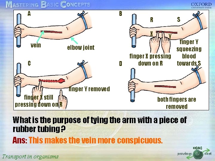A B R S 按一下以編輯母片標題樣式 X Y vein elbow joint finger Y squeezing finger