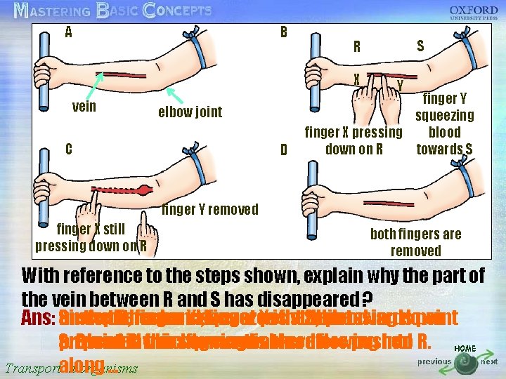 A B R S 按一下以編輯母片標題樣式 X Y vein elbow joint finger Y squeezing finger