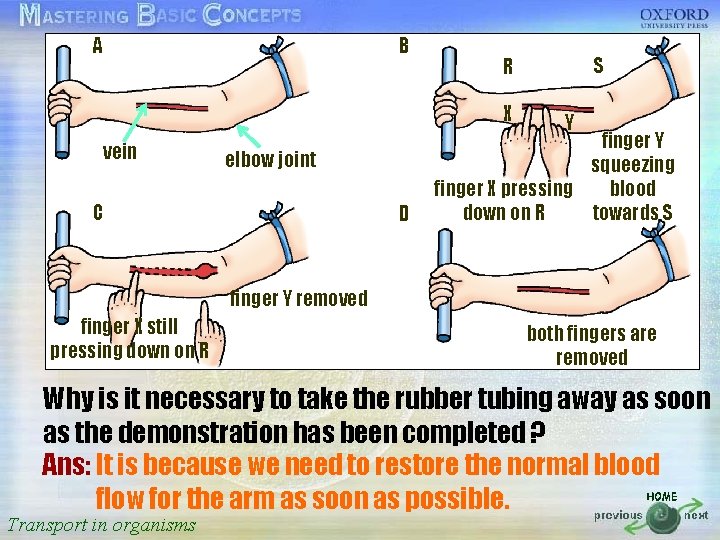 A B R S 按一下以編輯母片標題樣式 X Y vein elbow joint finger Y squeezing finger