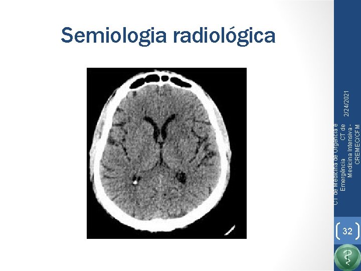 CT de Medicina de Urgência e Emergência CT de Medicina Intensiva CREMEC/CFM 2/24/2021 Semiologia