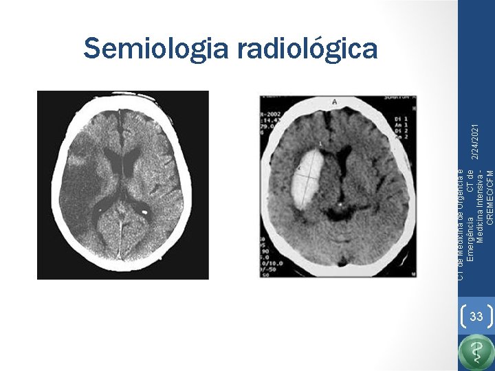 CT de Medicina de Urgência e Emergência CT de Medicina Intensiva CREMEC/CFM 2/24/2021 Semiologia