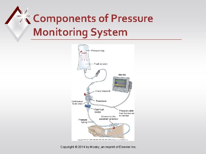 Components of Pressure Monitoring System Copyright © 2014 by Mosby, an imprint of Elsevier