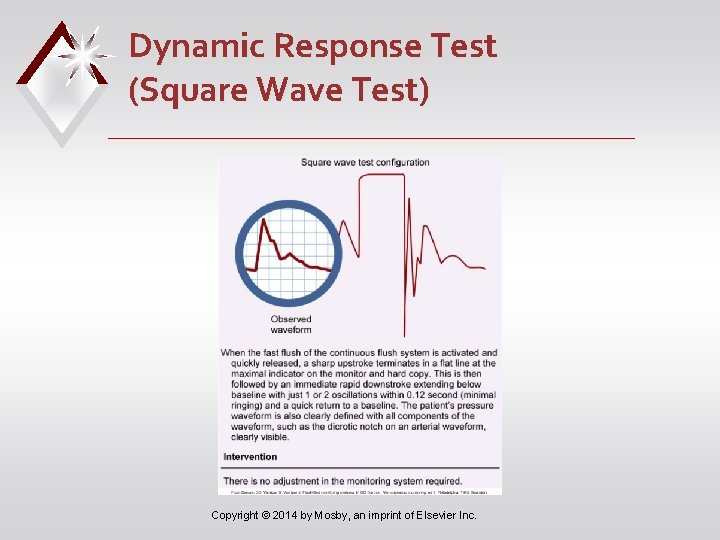 Dynamic Response Test (Square Wave Test) Copyright © 2014 by Mosby, an imprint of