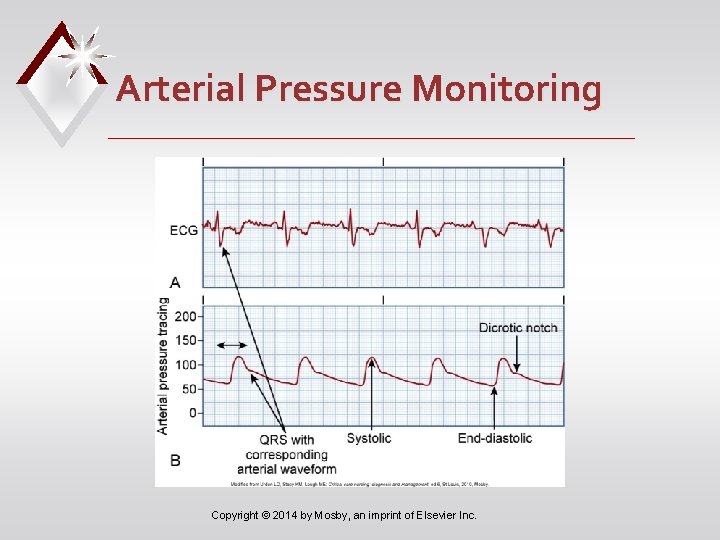 Arterial Pressure Monitoring Copyright © 2014 by Mosby, an imprint of Elsevier Inc. 
