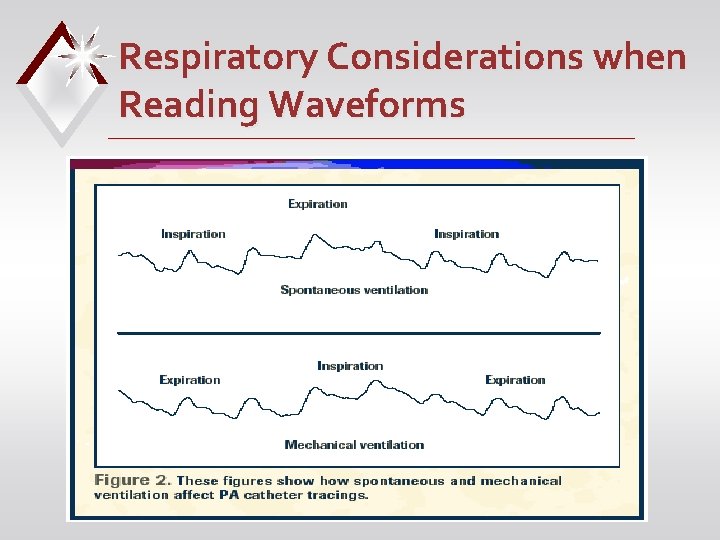 Respiratory Considerations when Reading Waveforms 