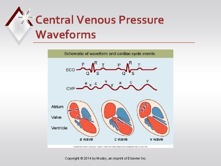 Central Venous Pressure Waveforms Copyright © 2014 by Mosby, an imprint of Elsevier Inc.