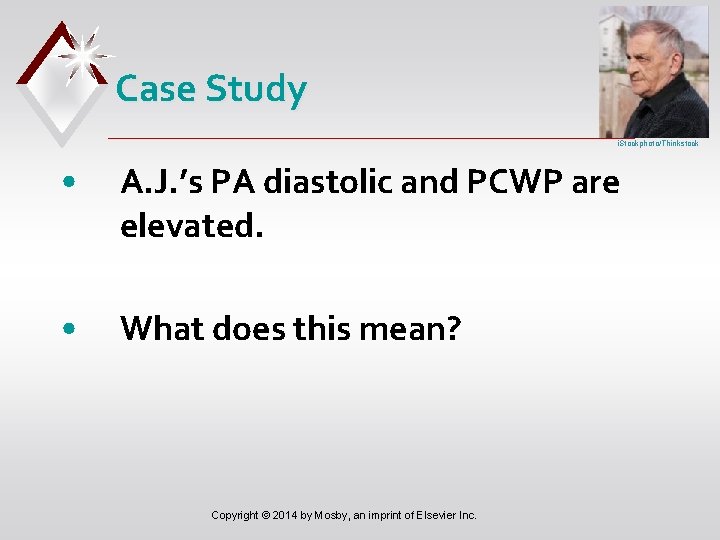 Case Study i. Stockphoto/Thinkstock • A. J. ’s PA diastolic and PCWP are elevated.