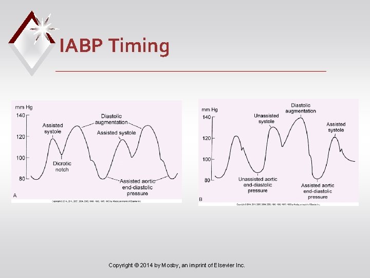 IABP Timing Copyright © 2014 by Mosby, an imprint of Elsevier Inc. 