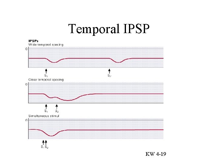 Temporal IPSP KW 4 -19 