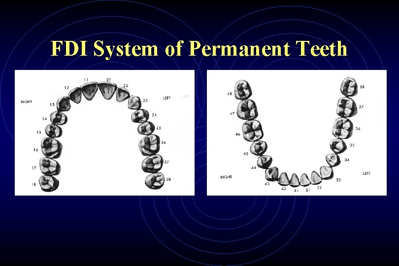 FDI System of Permanent Teeth 