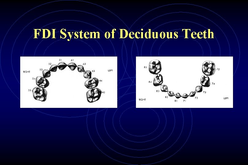 FDI System of Deciduous Teeth 