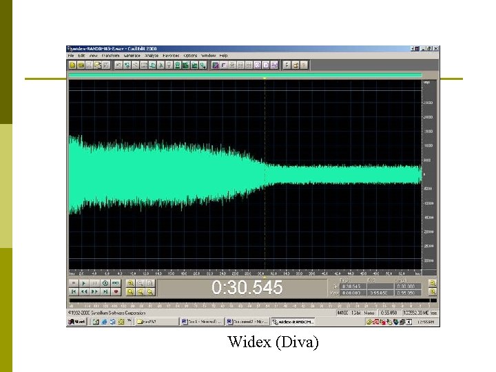Widex (Diva) Widex (Diva)