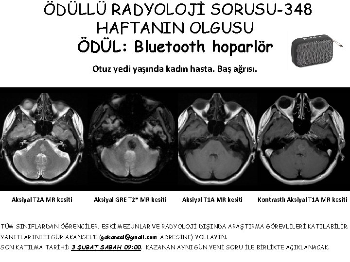 ÖDÜLLÜ RADYOLOJİ SORUSU-348 HAFTANIN OLGUSU ÖDÜL: Bluetooth hoparlör Otuz yedi yaşında kadın hasta. Baş