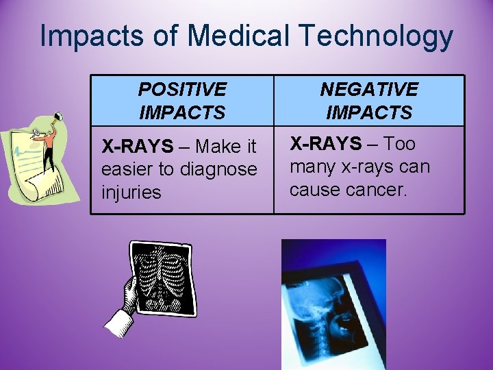 Impacts of Medical Technology POSITIVE IMPACTS X-RAYS – Make it easier to diagnose injuries