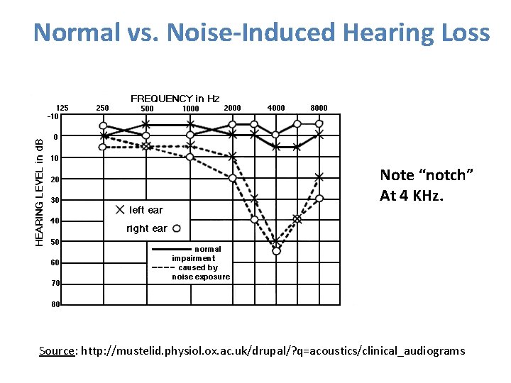 Normal vs. Noise-Induced Hearing Loss Note “notch” At 4 KHz. Source: http: //mustelid. physiol.