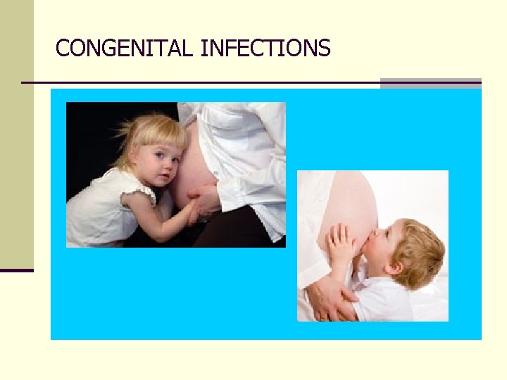 CONGENITAL INFECTIONS 