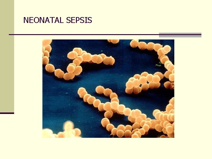 NEONATAL SEPSIS 