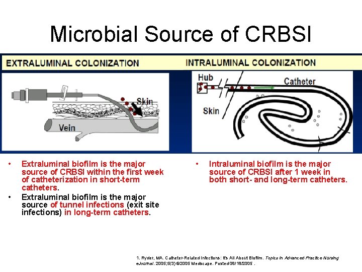 Impact of Primary BSI Pathophysiology of Catheter Related