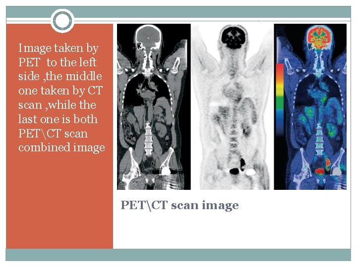 Image taken by PET to the left side , the middle one taken by