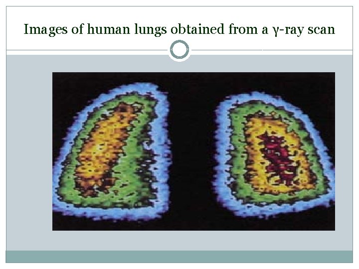 Images of human lungs obtained from a γ-ray scan 