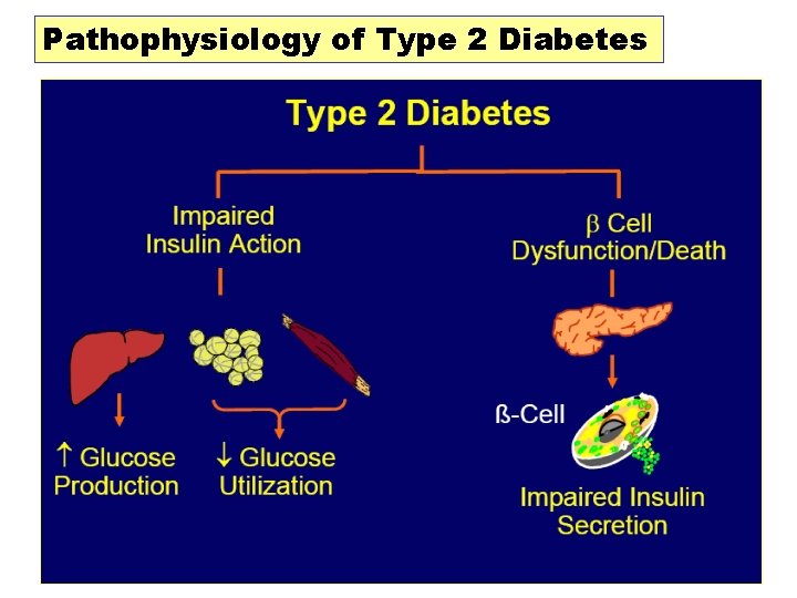 Pathophysiology of Type 2 Diabetes 16 