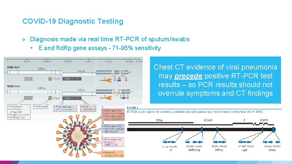COVID-19 Diagnostic Testing v Diagnosis made via real time RT-PCR of sputum/swabs • E COVID-19 Diagnostic Testing v Diagnosis made via real time RT-PCR of sputum/swabs • E