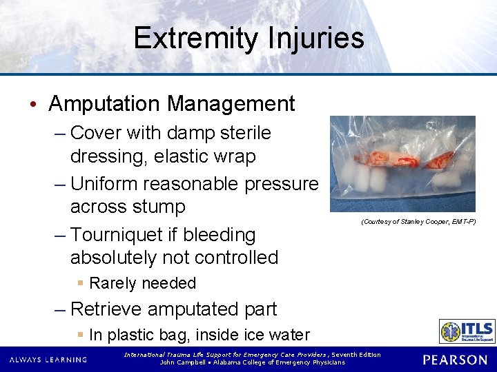 Extremity Injuries • Amputation Management – Cover with damp sterile dressing, elastic wrap –