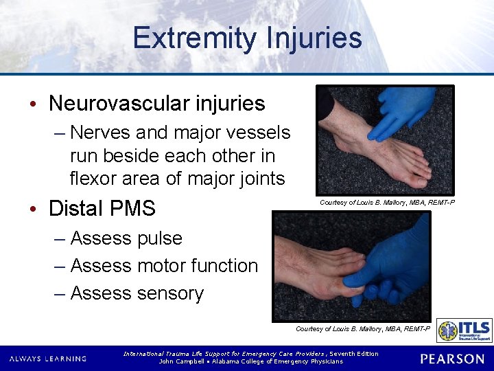 Extremity Injuries • Neurovascular injuries – Nerves and major vessels run beside each other