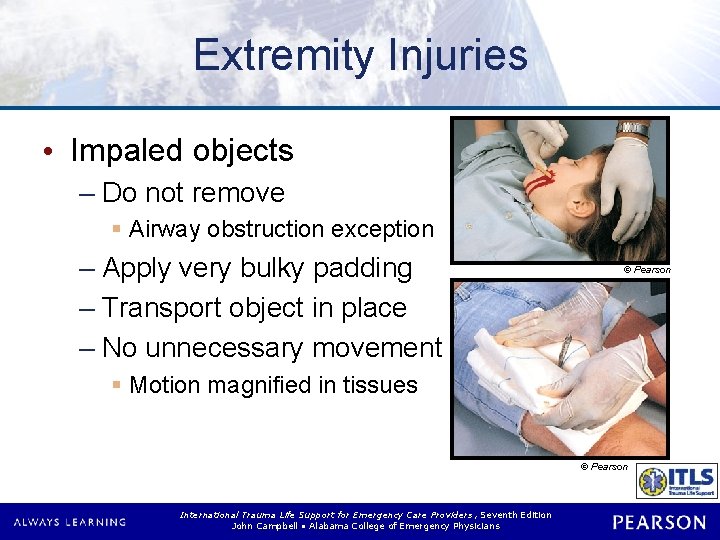 Extremity Injuries • Impaled objects – Do not remove § Airway obstruction exception –