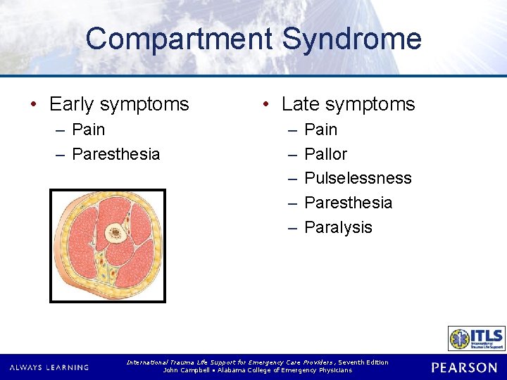 Compartment Syndrome • Early symptoms – Pain – Paresthesia • Late symptoms – –