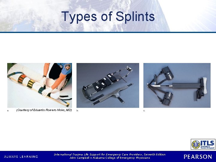Types of Splints (Courtesy of Eduardo Romero Hicks, MD) International Trauma Life Support for