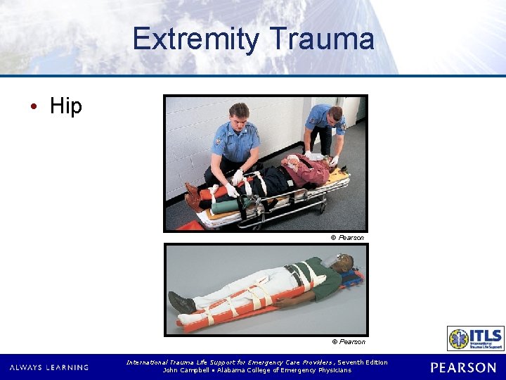 Extremity Trauma • Hip © Pearson International Trauma Life Support for Emergency Care Providers,