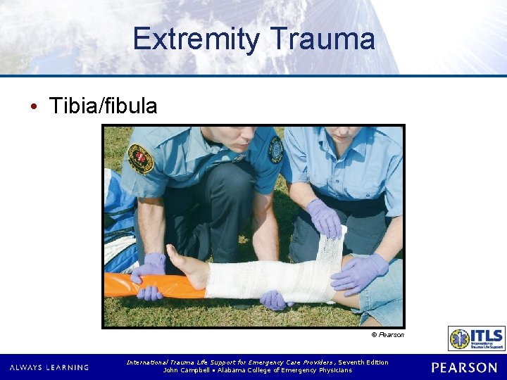 Extremity Trauma • Tibia/fibula © Pearson International Trauma Life Support for Emergency Care Providers,