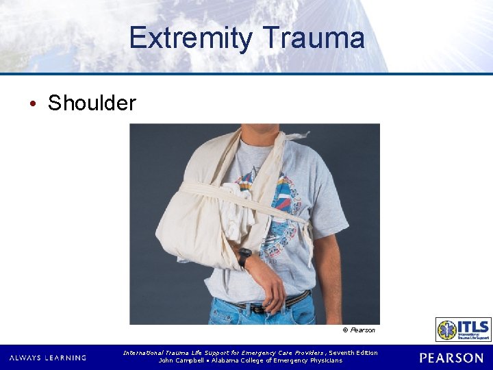 Extremity Trauma • Shoulder © Pearson International Trauma Life Support for Emergency Care Providers,