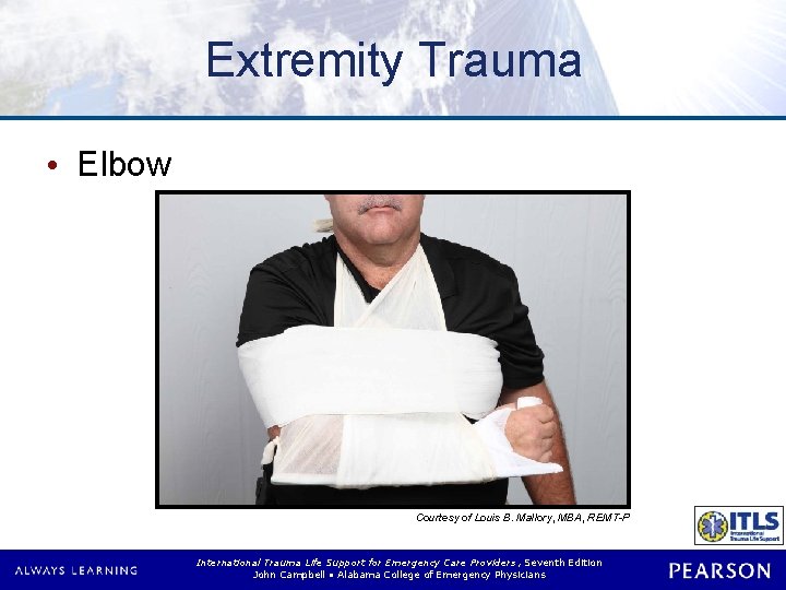 Extremity Trauma • Elbow Courtesy of Louis B. Mallory, MBA, REMT-P International Trauma Life