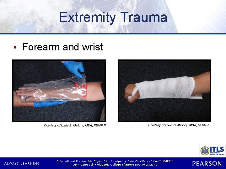 Extremity Trauma • Forearm and wrist Courtesy of Louis B. Mallory, MBA, REMT-P International
