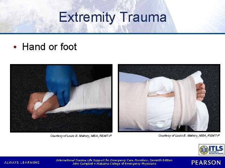Extremity Trauma • Hand or foot Courtesy of Louis B. Mallory, MBA, REMT-P International