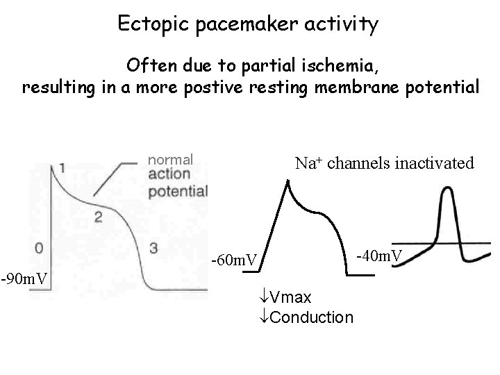 Ectopic pacemaker activity Often due to partial ischemia, resulting in a more postive resting