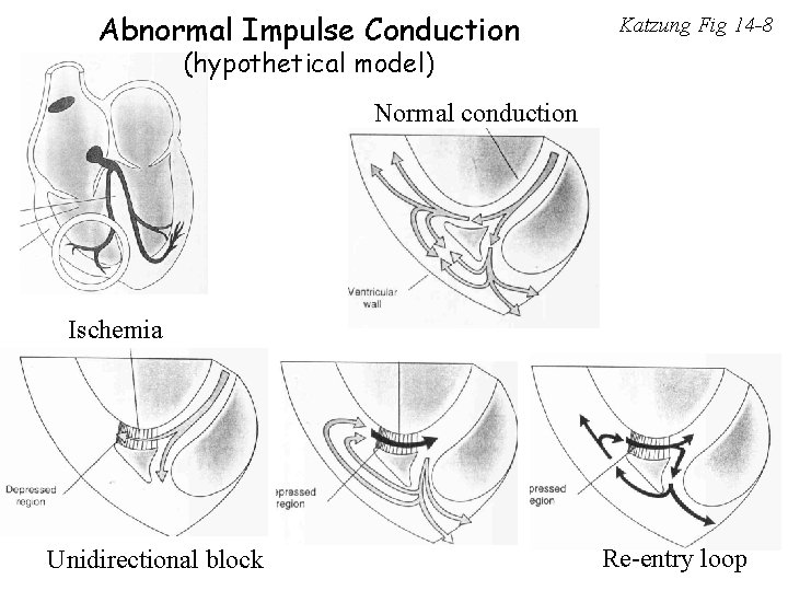 Abnormal Impulse Conduction Katzung Fig 14 -8 (hypothetical model) Normal conduction Ischemia Unidirectional block