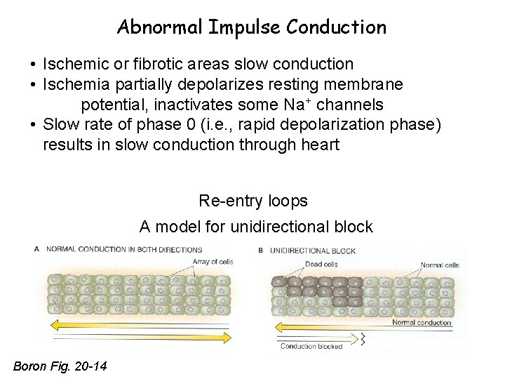 Abnormal Impulse Conduction • Ischemic or fibrotic areas slow conduction • Ischemia partially depolarizes