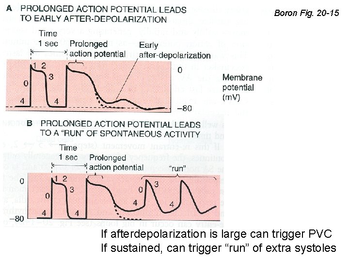 Boron Fig. 20 -15 If afterdepolarization is large can trigger PVC If sustained, can