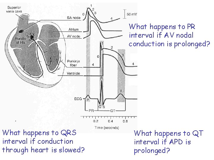 What happens to PR interval if AV nodal conduction is prolonged? What happens to