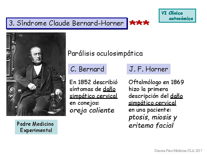 3. Síndrome Claude Bernard-Horner *** VI Clínica autonómica Parálisis oculosimpática C. Bernard J. F.